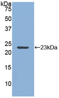 1 - Polyclonal Antibody to Matrix Metalloproteinase 12 (MMP12) AP74691