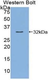 1 - Polyclonal Antibody to Kallikrein 9 (KLK9) AP74588