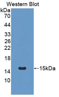 1 - Polyclonal Antibody to Osteocalcin (OC) AP74695