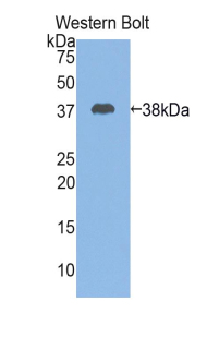1 - Polyclonal Antibody to Cystatin A (CSTA) AP74667