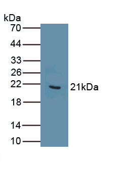 1 - Polyclonal Antibody to Myoglobin (MYO) AP74506