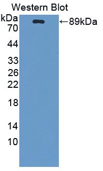 1 - Polyclonal Antibody to Tissue Plasminogen Activator (tPA) AP74589