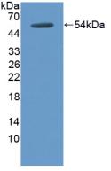 1 - Polyclonal Antibody to Thrombomodulin (TM) AP74590