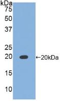 1 - Polyclonal Antibody to Tissue Inhibitors Of Metalloproteinase 1 (TIMP1) AP74591