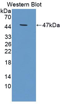 1 - Polyclonal Antibody to Tissue Inhibitors Of Metalloproteinase 1 (TIMP1) AP74592