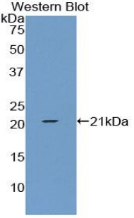1 - Polyclonal Antibody to Tissue Inhibitors Of Metalloproteinase 1 (TIMP1) AP74631