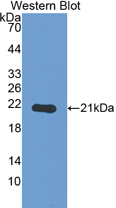 1 - Polyclonal Antibody to Thyroid Peroxidase (TPO) AP74593