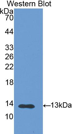 1 - Polyclonal Antibody to S100 Calcium Binding Protein A11 (S100A11) AP74635