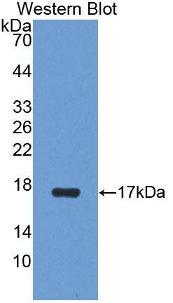 1 - Polyclonal Antibody to Aquaporin 1 (AQP1) AP74761