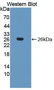 1 - Polyclonal Antibody to Thrombospondin 1 (THBS1) AP74594