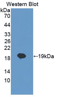 1 - Polyclonal Antibody to Interleukin 7 (IL7) AP74745