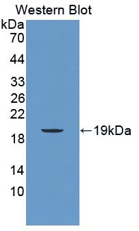 1 - Polyclonal Antibody to Mucin 5 Subtype B (MUC5B) AP74483