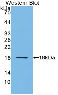 1 - Polyclonal Antibody to Prealbumin (PALB) AP74713