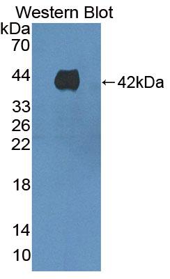 1 - Polyclonal Antibody to Kidney Injury Molecule 1 (Kim1) AP74765