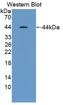 1 - Polyclonal Antibody to Cholecystokinin (CCK) AP74696
