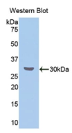1 - Polyclonal Antibody to Cholesteryl Ester Transfer Protein (CETP) AP74655