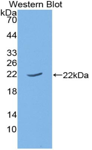 1 - Polyclonal Antibody to Parathyroid Hormone Related Protein (PTHrP) AP74697