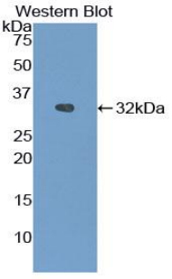 1 - Polyclonal Antibody to Heat Shock Protein 90kDa Beta 1 (HSP90b1) AP74595