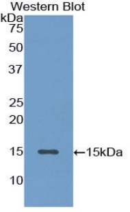 1 - Polyclonal Antibody to Inhibin Beta A (INHbA) AP74688