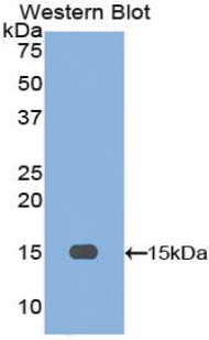 1 - Polyclonal Antibody to Inhibin Beta A (INHbA) AP74627