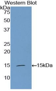1 - Polyclonal Antibody to Inhibin Beta A (INHbA) AP74689
