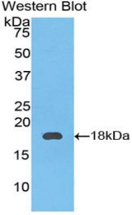 1 - Polyclonal Antibody to Coagulation Factor IX (F9) AP74638