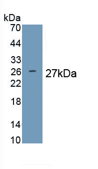 1 - Polyclonal Antibody to Prolactin (PRL) AP74596