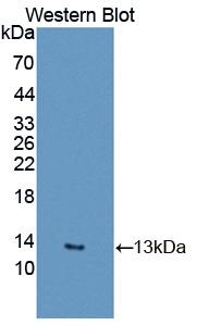 1 - Polyclonal Antibody to Resistin (RETN) AP74752