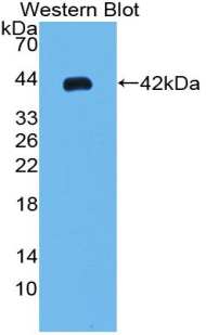 1 - Polyclonal Antibody to Parathyroid Hormone (PTH) AP74598