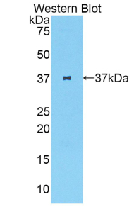 1 - Polyclonal Antibody to Parathyroid Hormone (PTH) AP74599