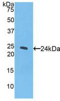 1 - Polyclonal Antibody to Peroxisome Proliferator Activated Receptor Gamma (PPARg) AP74601