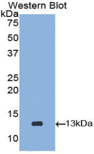 1 - Polyclonal Antibody to Cystatin C (Cys-C) AP74639