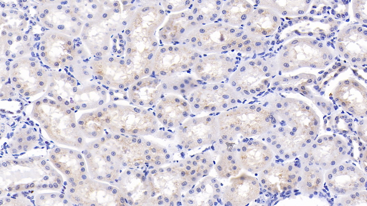 2 - Polyclonal Antibody to Osteopontin (OPN) AP74798