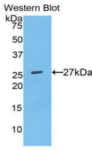 1 - Polyclonal Antibody to Osteopontin (OPN) AP74602