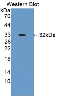 1 - Polyclonal Antibody to Osteopontin (OPN) AP74747