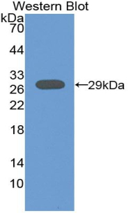 1 - Polyclonal Antibody to Acid Phosphatase 5, Tartrate Resistant (ACP5) AP74673