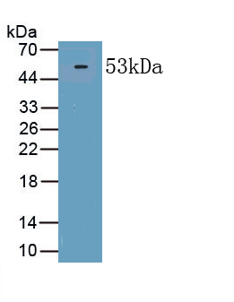 1 - Polyclonal Antibody to Procollagen I N-Terminal Propeptide (PINP) AP74647