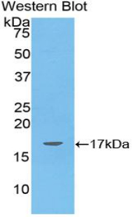 1 - Polyclonal Antibody to Angiopoietin Like Protein 4 (ANGPTL4) AP74648