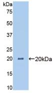 1 - Polyclonal Antibody to Angiopoietin Like Protein 4 (ANGPTL4) AP74649