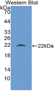 1 - Polyclonal Antibody to Beta-Lactoglobulin (bLg) AP74494