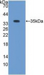 1 - Polyclonal Antibody to Protein Kinase C Beta 1 (PKCb1) AP74637
