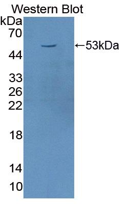 1 - Polyclonal Antibody to Transferrin Receptor (TFR) AP74748