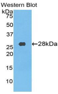 1 - Polyclonal Antibody to Transferrin Receptor (TFR) AP74670