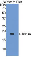 1 - Polyclonal Antibody to Lysozyme (LZM) AP74505