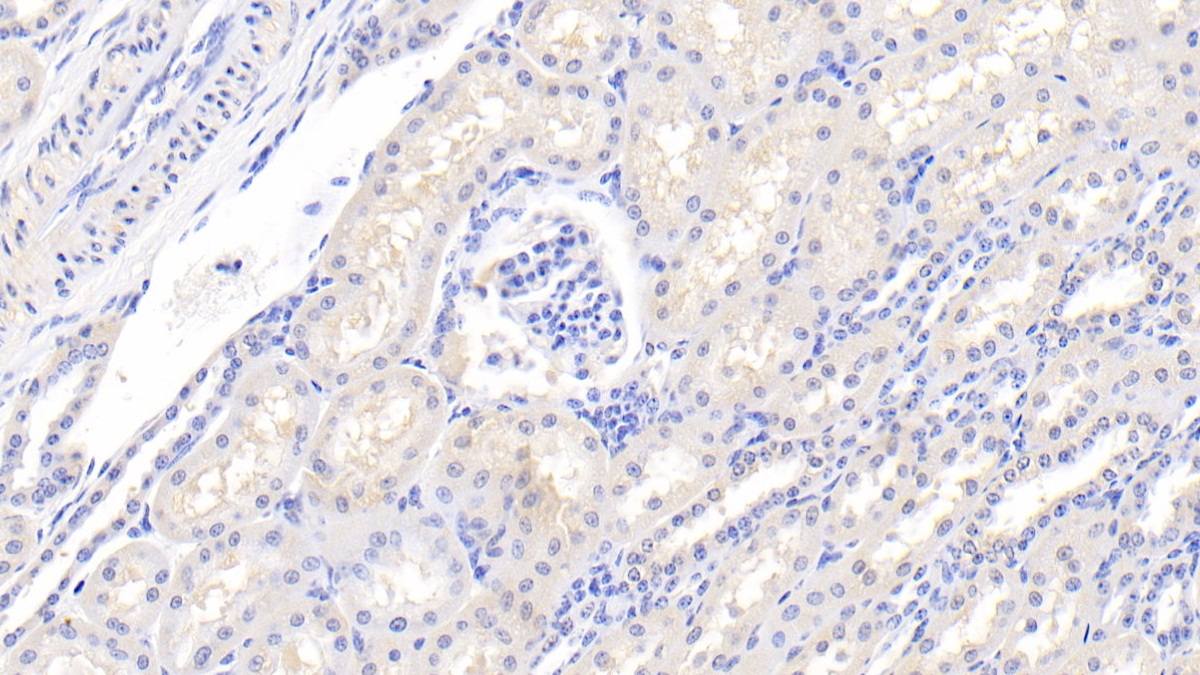 2 - Polyclonal Antibody to Integrin Alpha 2 (ITGa2) AP74801
