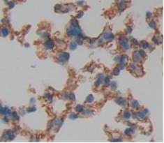 2 - Polyclonal Antibody to Integrin Alpha 5 (ITGa5) AP74800