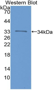 1 - Polyclonal Antibody to Integrin Alpha 1 (ITGa1) AP74715