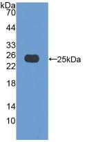 1 - Polyclonal Antibody to Bcl2 Associated X Protein (Bax) AP74604