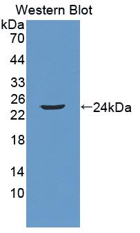 1 - Polyclonal Antibody to Neutrophil gelatinase-associated lipocalin (NGAL) AP74605