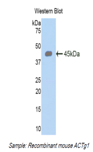 1 - Polyclonal Antibody to Gamma Actin (ACTG) AP74653
